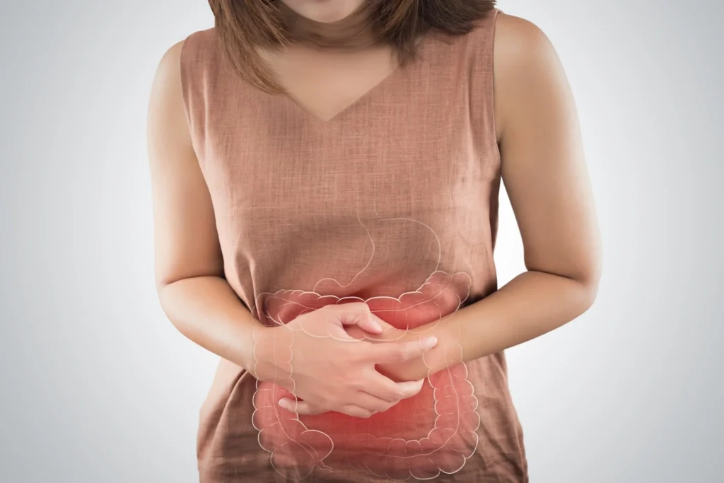 Constipation After Gastric Sleeve