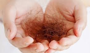hair loss after bariatric surgery