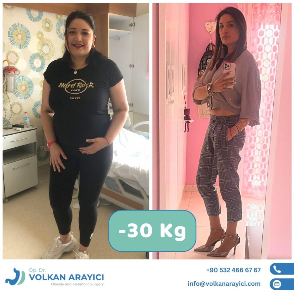 Best Gastric Sleeve Clinic in Turkey