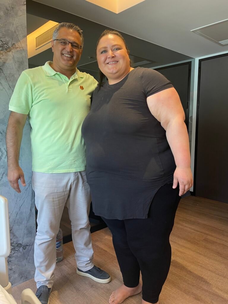 Gastric Sleeve Turkey Experiences