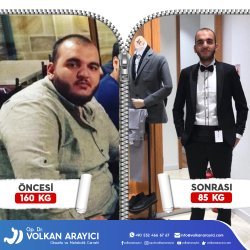 Magen Op Türkei Erfahrungen 