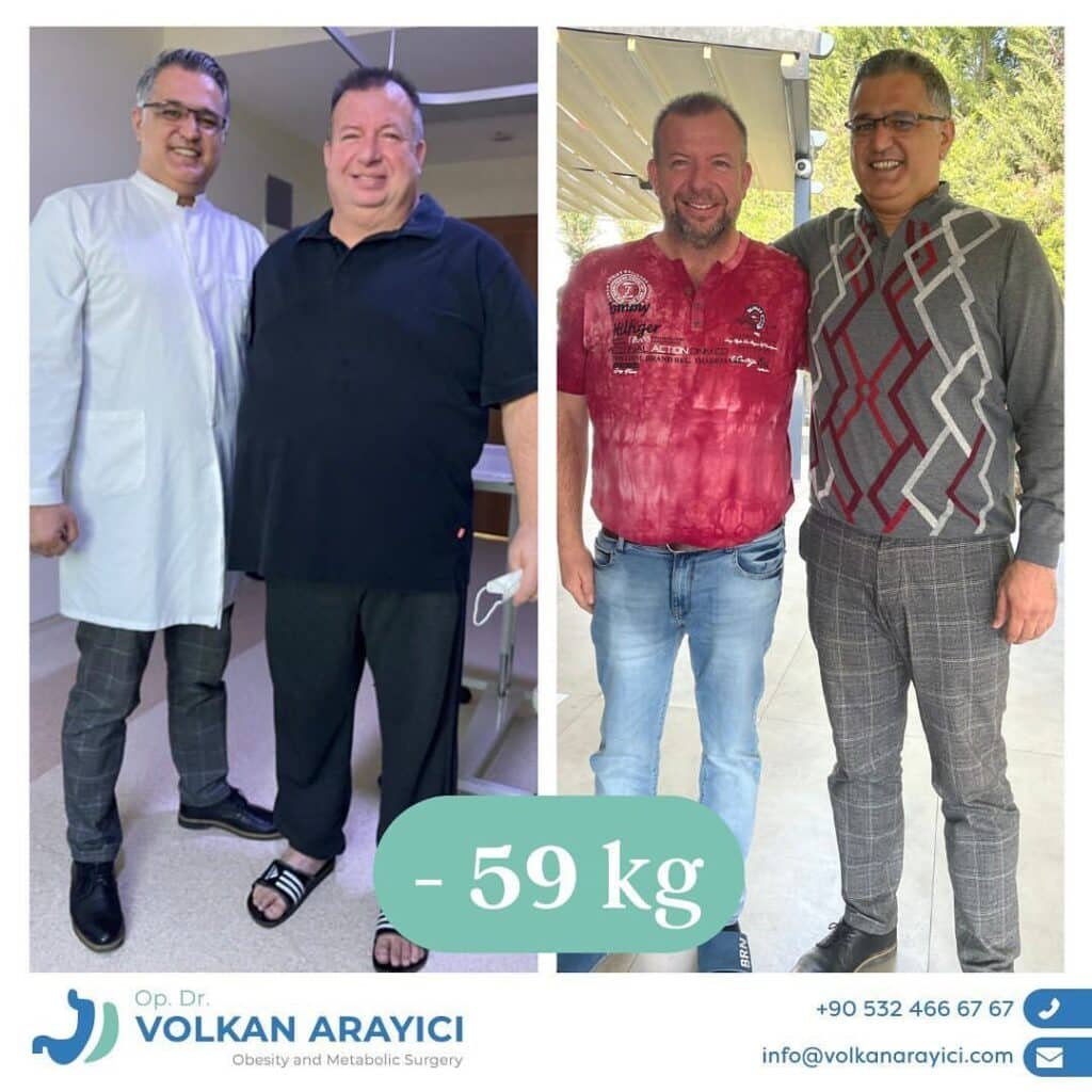 Schlauchmagen Türkei Beste Klinik