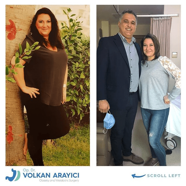 Für Wen Ist Ein Schlauchmagen Oder Mini Magenbypass Das Richtige?