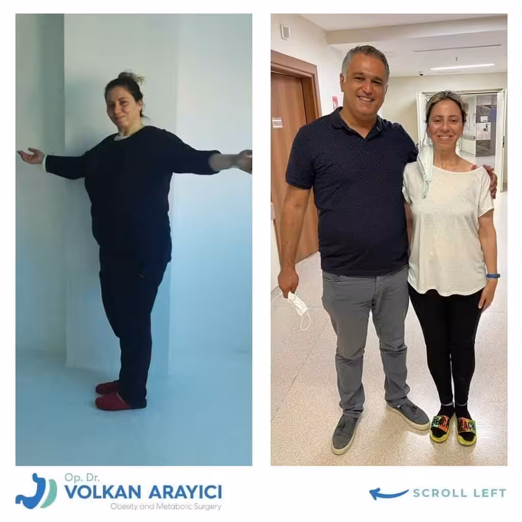 Wie viel kostet eine Gewichtsverlust operation in der Türkei? Gewichtsverlust operation in der Türkei