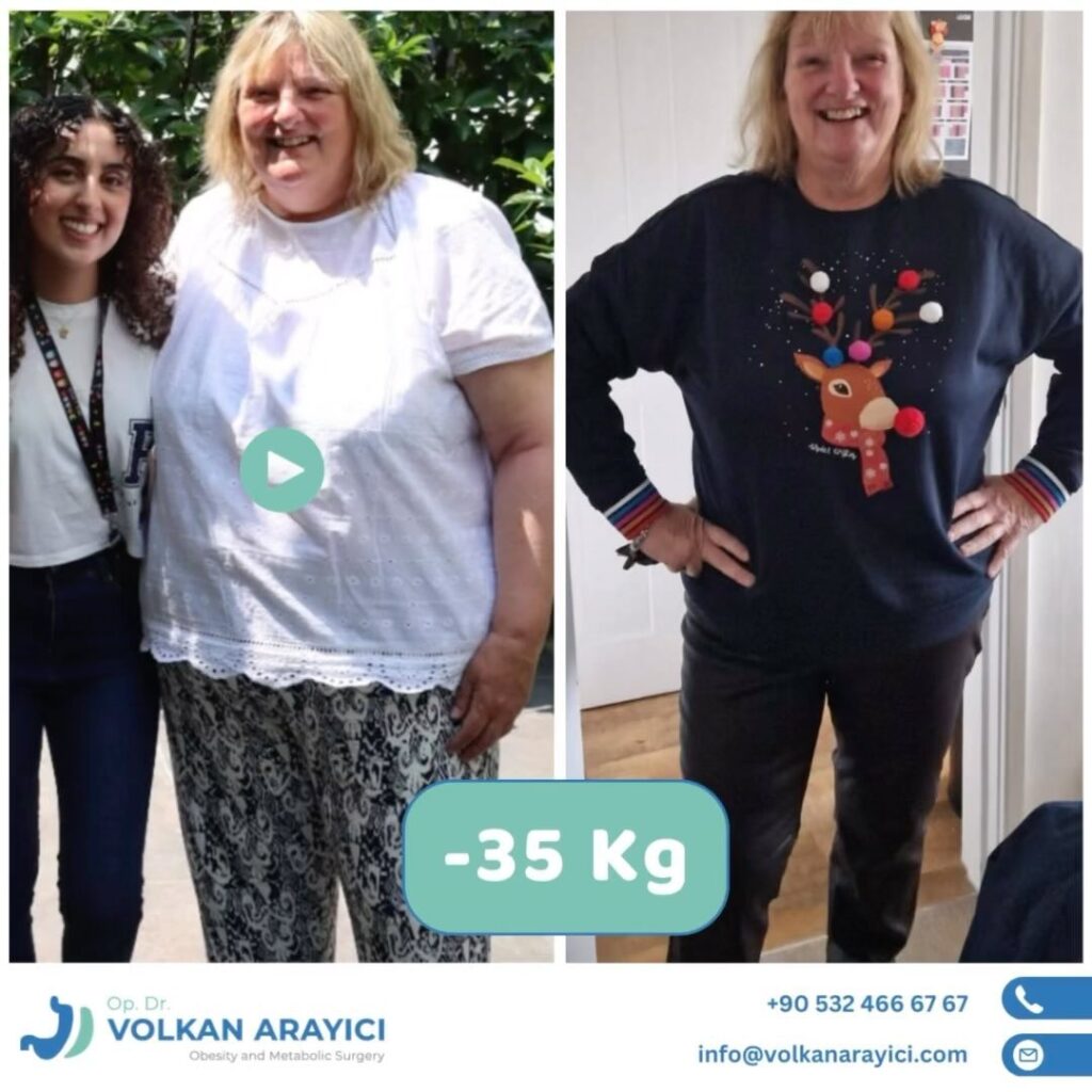 Entfernung des Magenbandes und Umstellung auf Schlauchmagen oder Magenbypass Magenband Revisionoperation bariatrische revisionschirurgie in der türkei