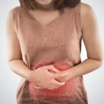 Constipation After Gastric Sleeve