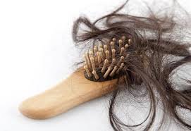 hair loss after gastric sleeve surgery