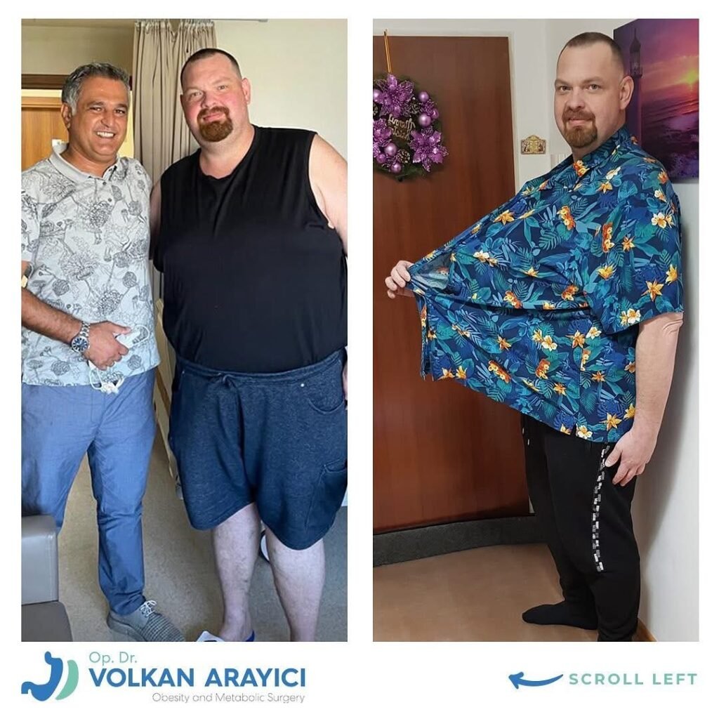 Magenband Revision in der Türkei i