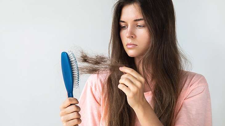 Möglicher Haarausfall Nach Der Schlauchmagen Op
