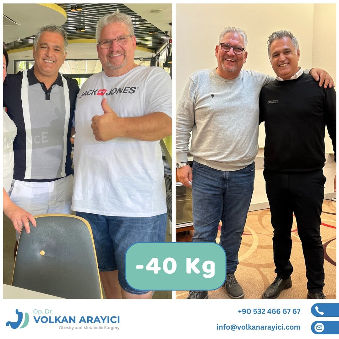 schlauchmagen nach magenband