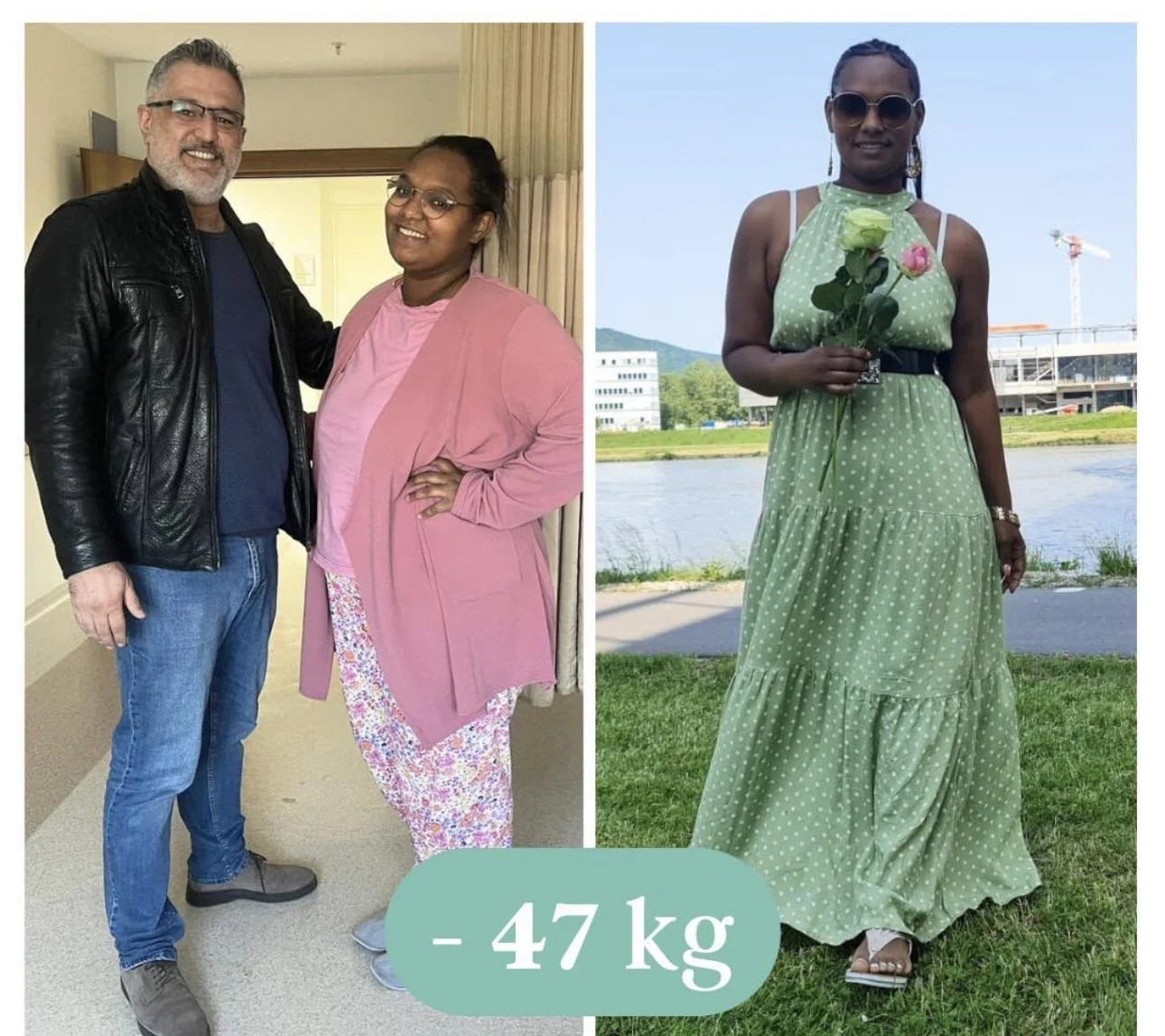 Schlauchmagen Türkei İzmir: Der Ultimative Leitfaden Schlauchmagen Türkei İzmir - Vorher-Nachher-Bilder