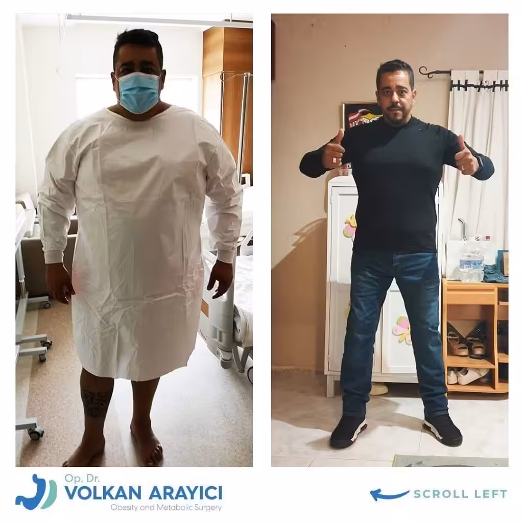 Introduction to Bariatric Surgery bariatric surgery in turkey