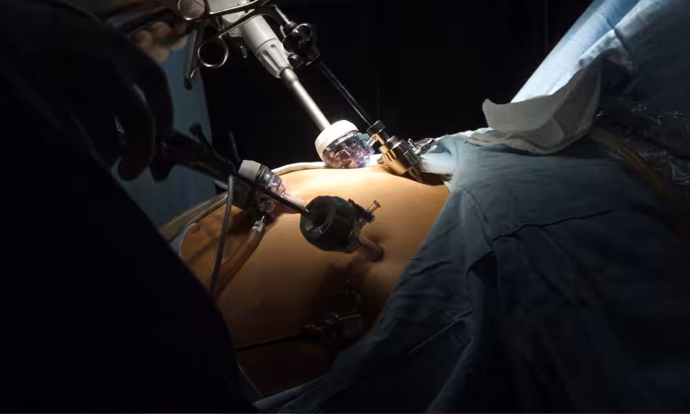 Einführung in bariatrische Operationen obesity1