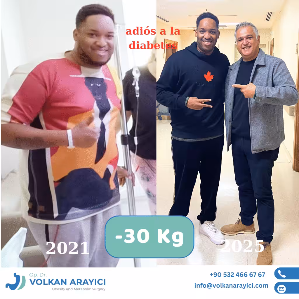 Reducción de estómago Turquía reduccion de estomago en turquia costos