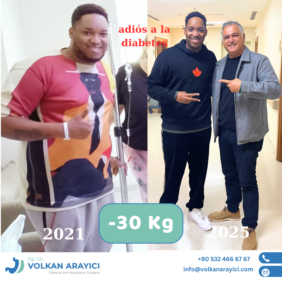 reduccion de estomago en turquia costos