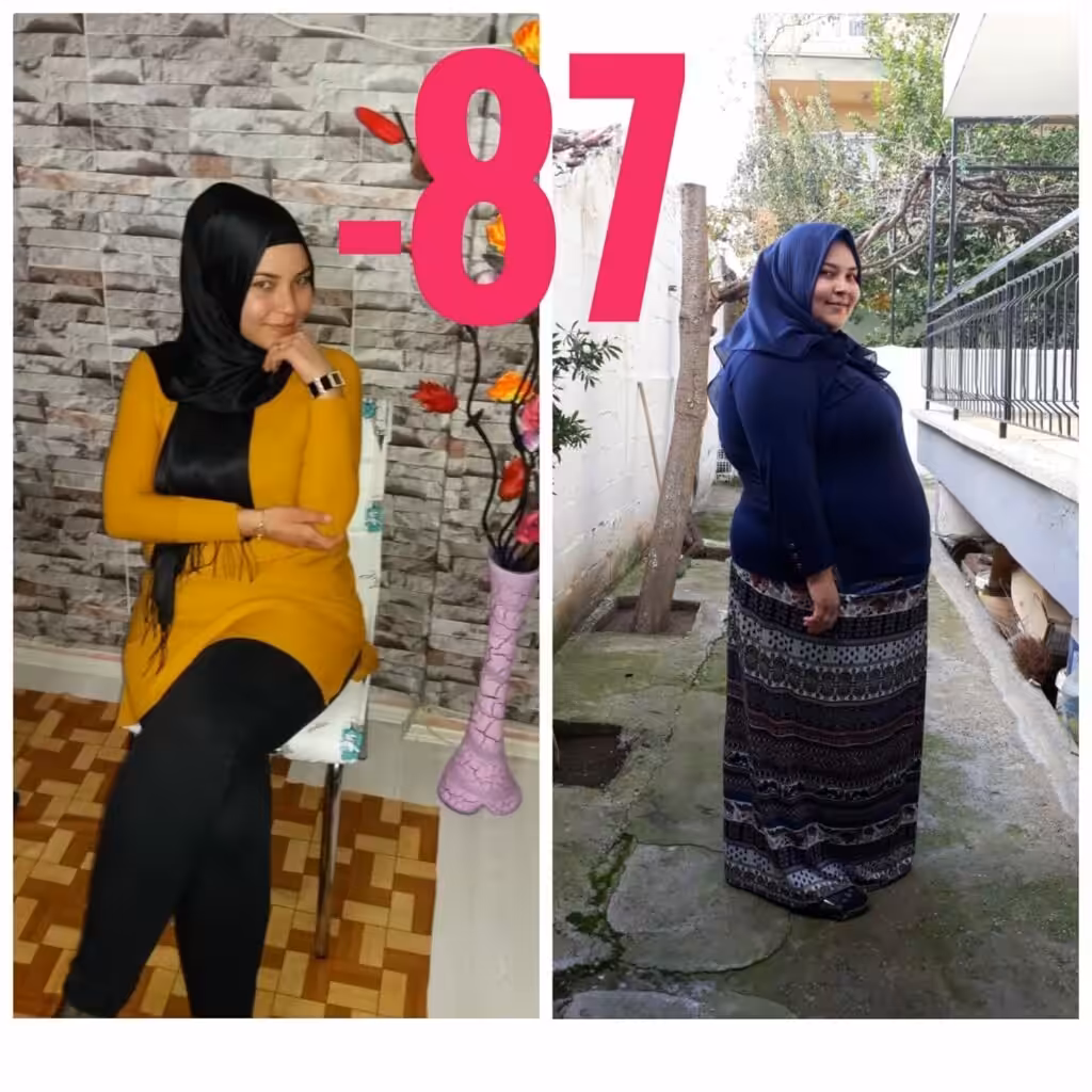 Introduction to Bariatric Surgery stomach tube surgery turkey