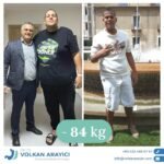 Gastric Sleeve Turkey Experiences