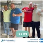 Gastric Sleeve Turkey Experiences