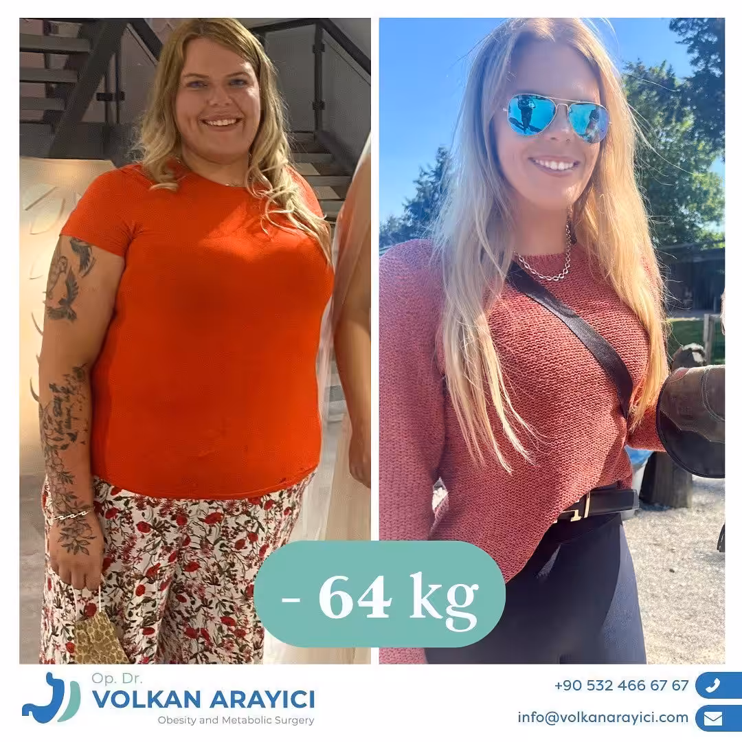 Schlauchmagen Türkei schlauchmagen op türkei all inclusive