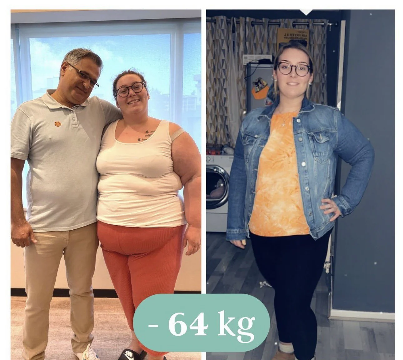 Magenbypass Kosten in der Türkei: Alles, was Sie wissen müssen Magenbypass Kosten Türkei - Vorher Nachher Ergebnisse