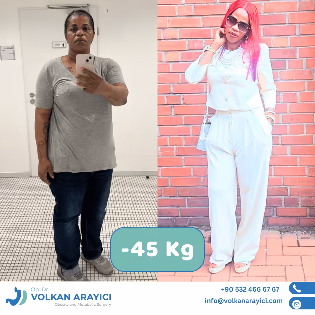 Beste Adipositas Klinik in der Türkei Beste Adipositas Klinik in der Türkei