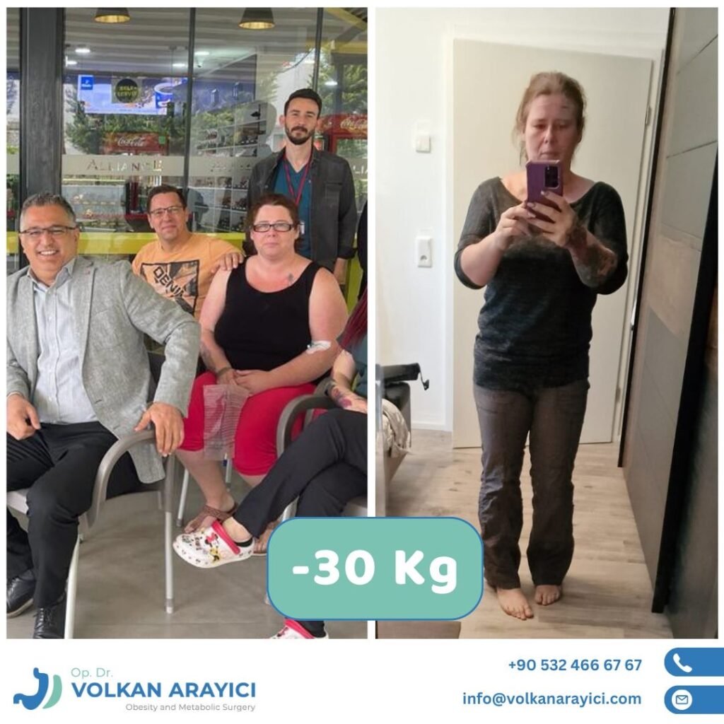 Wesensveranderung nach Magenbypass: Was Sie wissen sollten 3 magenbypass und lebensqualitat