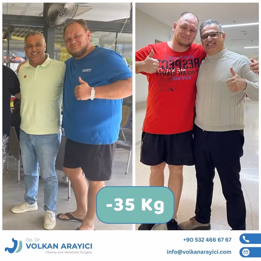 Comprehensive packages for weight loss surgery in Turkey include pre-op tests, surgery, hospital stay, and airport transfers