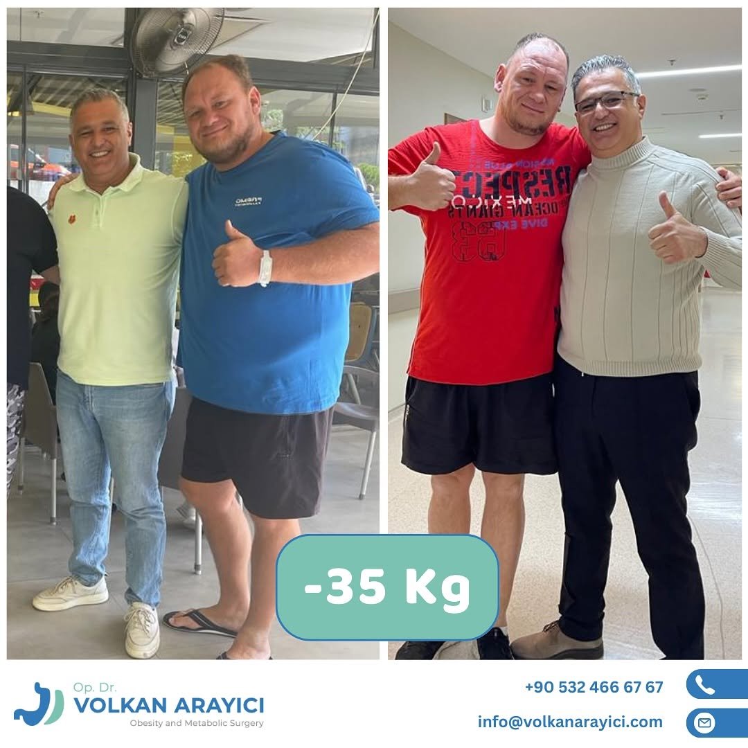 Comprehensive packages for weight loss surgery in Turkey include pre-op tests, surgery, hospital stay, and airport transfers