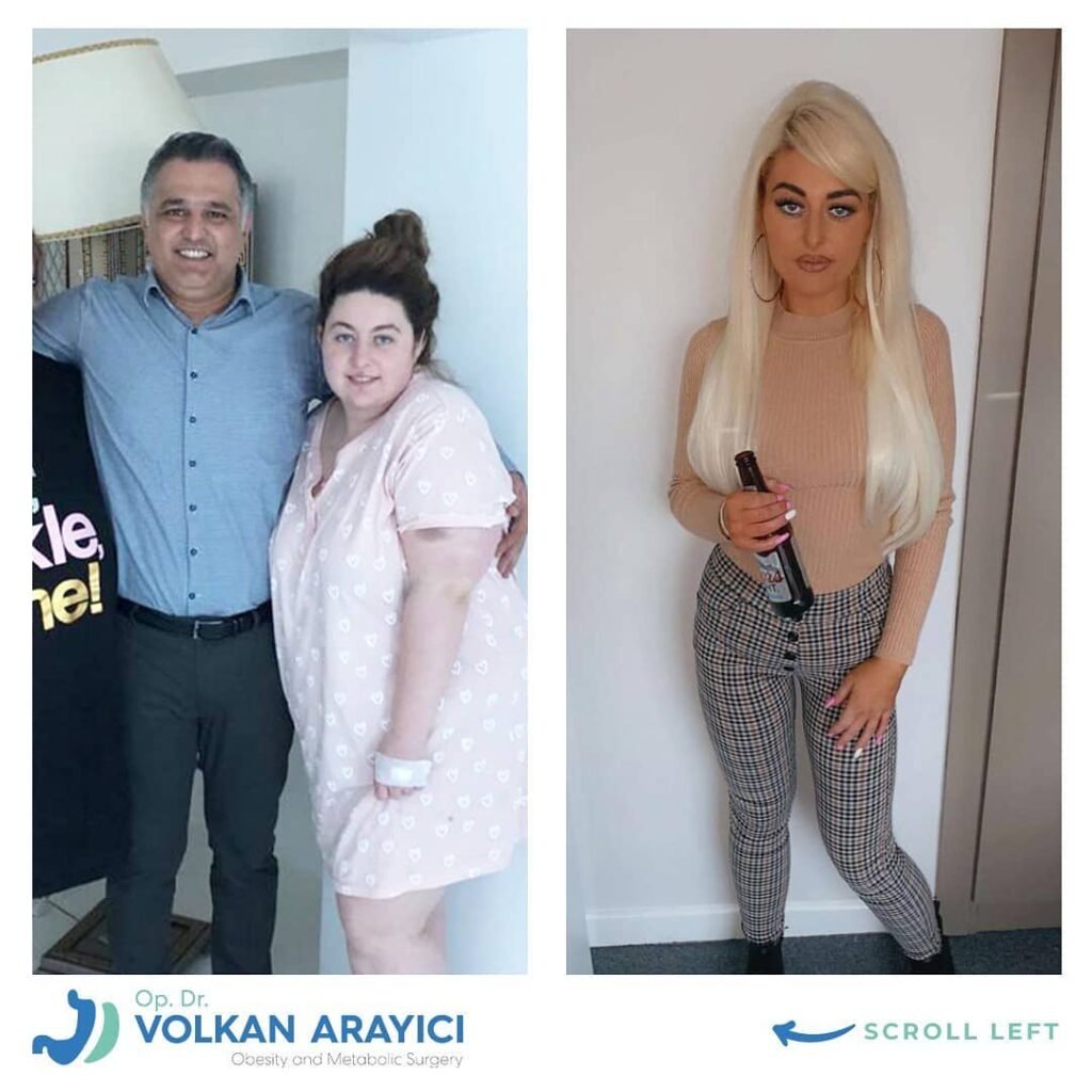 Ein Schritt zu einem neuen Leben mit der Magenschlauch Op magenschlauch kosten