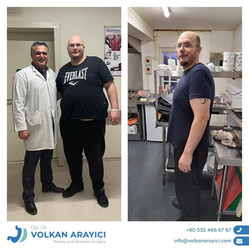 Schlauchmagen Op Türkei Beste Klinik mit Dr. Volkan Arayıcı