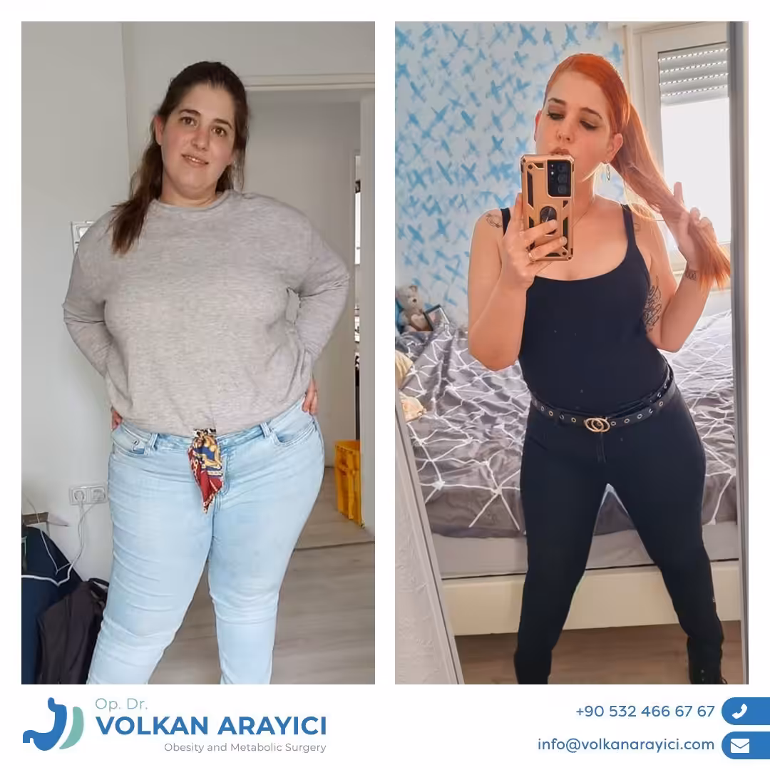 Kontakt Volkan ARAYICI - Beste Adipositas Klinik in der Türkei