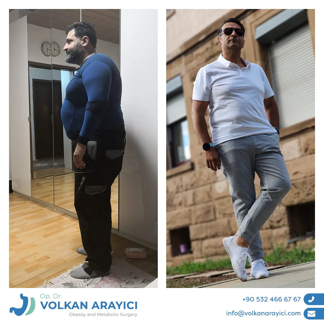 Über Volkan ARAYICI - Beste Adipositas Klinik in der Türkei
