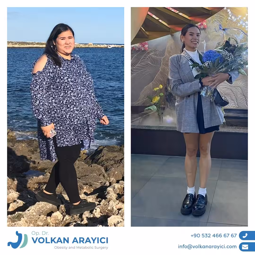 Kontakt Revisionchirurgie Türkei