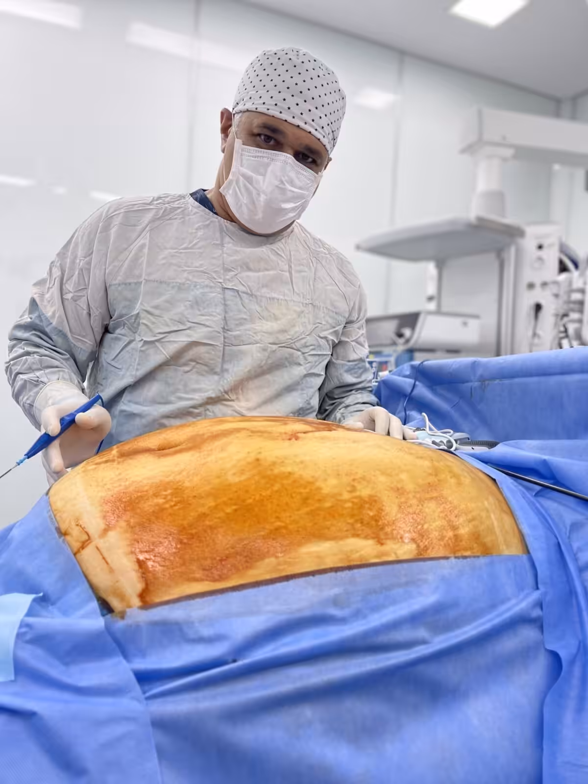 magenverkleinerung türkei all inclusive