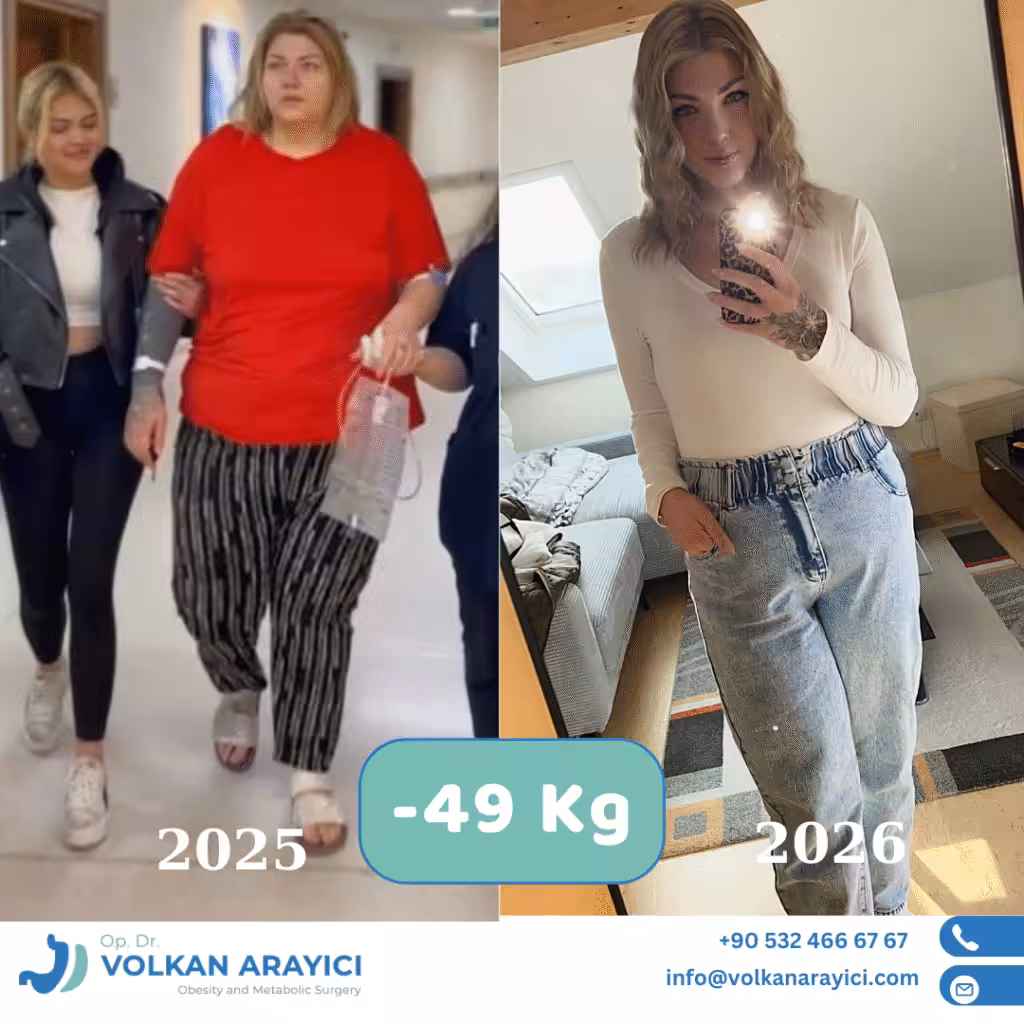 Bester Chirurg für Magenverkleinerung Türkei: Dr. Volkan Arayıcı beste adipositas klinik