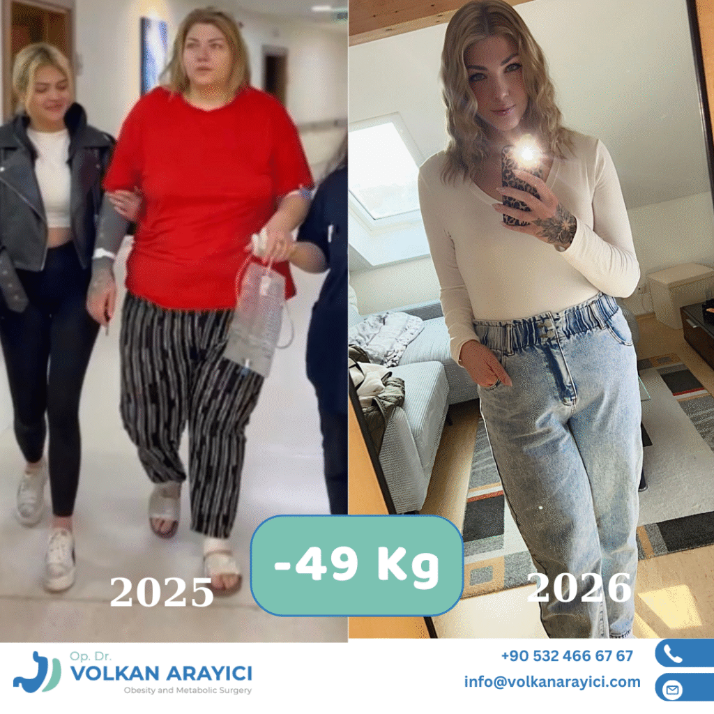 Bester Chirurg für Magenverkleinerung Türkei: Dr. Volkan Arayıcı beste adipositas klinik
