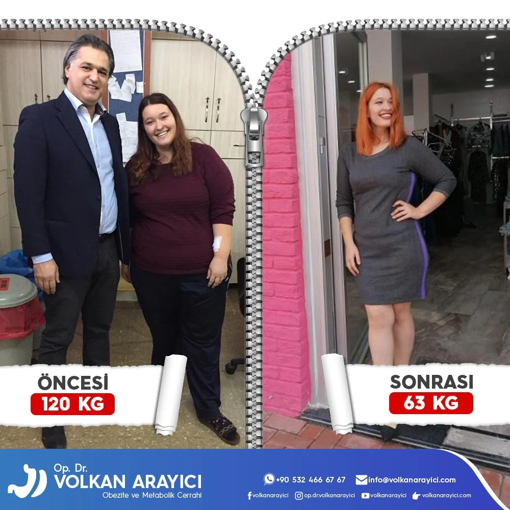 Bester Chirurg für Magenverkleinerung Türkei: Dr. Volkan Arayıcı beste chirurg für eine magenverkleinerung in der türkei
