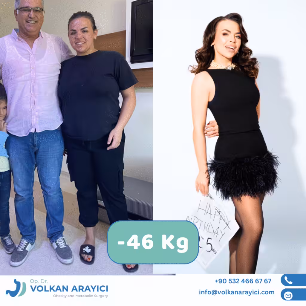 Schlauchmagen OP Türkei Beste Klinik Finden Schlauchmagen Op Türkei beste klinik - Nach Jahren der Diät und des Trainings, in denen sie ihr verlorenes Gewicht wieder zunahm, reiste Helen von Deutschland nach Izmir in der Türkei, um sich einer Schlauchmagenoperation in der Klinik von Dr. Volkan Arayıcı zu unterziehen. Helen verlor nach dem Schlauchmagen-Eingriff 46 Kilo. Sie wollte ihr Glück mit Ihnen teilen.