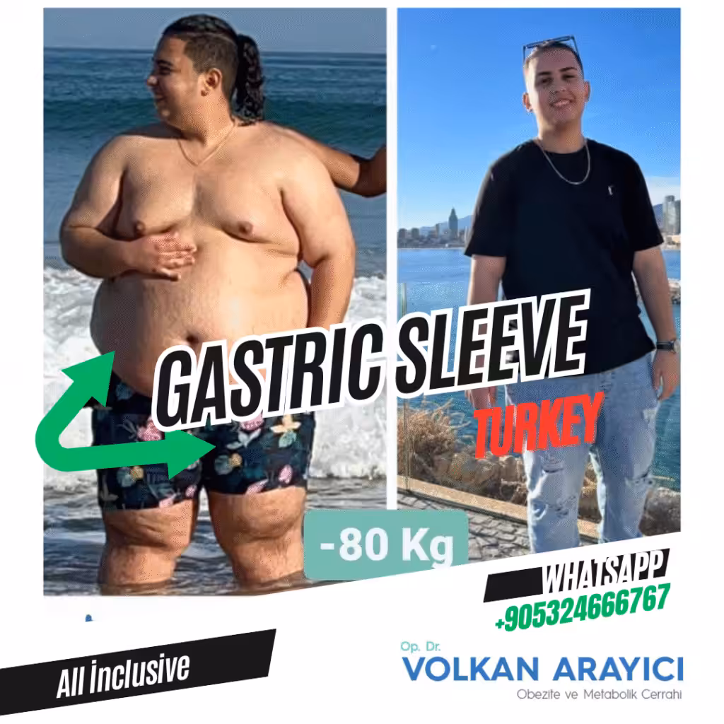 Cicatrices de la Manga Gástrica: Guía para una Curación Óptima Cicatrices de la Bypass Gastrico