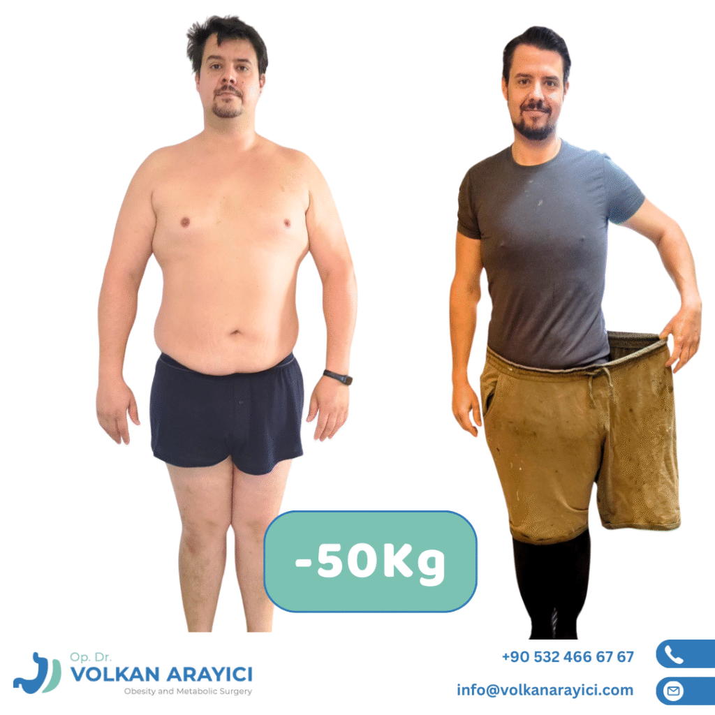 Gastric Balloon Turkey, Izmir