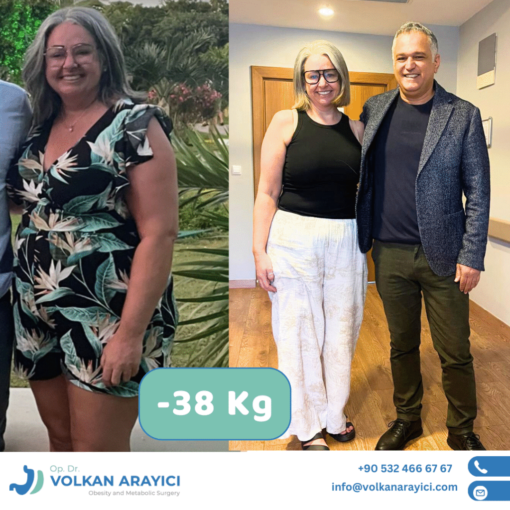Gastric Sleeve Turkey Best Clinic