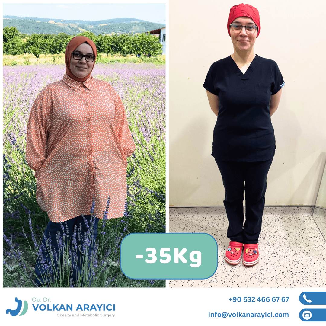 Mide Küçültme Ameliyatı İzmir Mide Küçültme Ameliyatı izmir