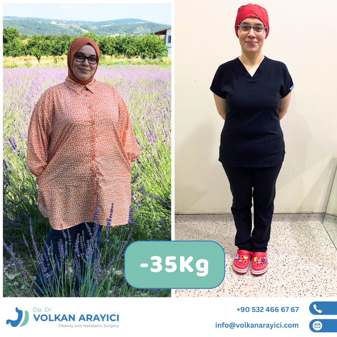 Mide Küçültme Ameliyatı izmir