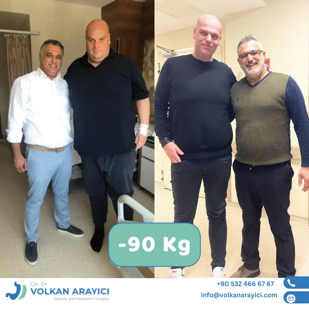 Gastric Sleeve in Izmir: Your Complete Guide Edgar, who came from Germany to Izmir, Türkiye, underwent gastric sleeve surgery. Having lost 90 kilos in a year, Edgar returned to Izmir to have his wife operated on by Dr. Volkan Arayıcı. Gastric Sleeve izmir
