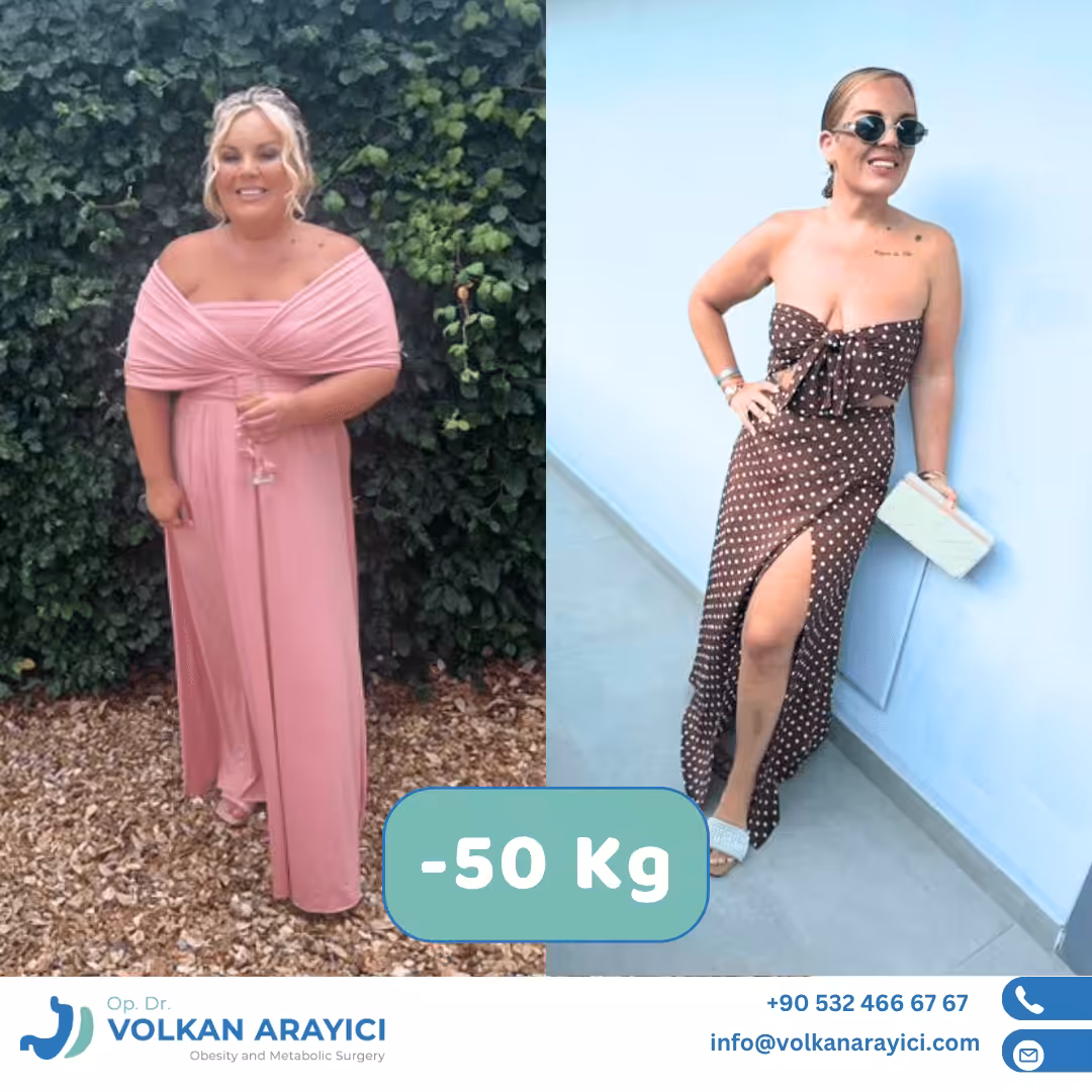 magenverkleinerung türkei paket