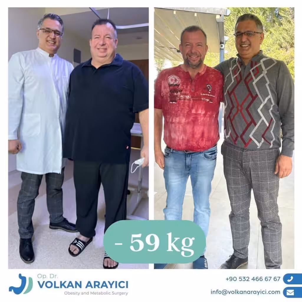 Magen Op Türkei: Kosten, Vorteile und Erfahrungen Schlauchmagen Türkei Beste Klinik