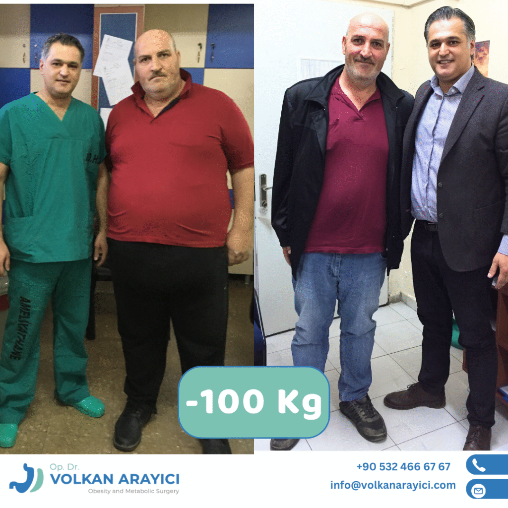 Tüp Mide Ameliyatı Izmir - Op.Dr.Volkan Arayici