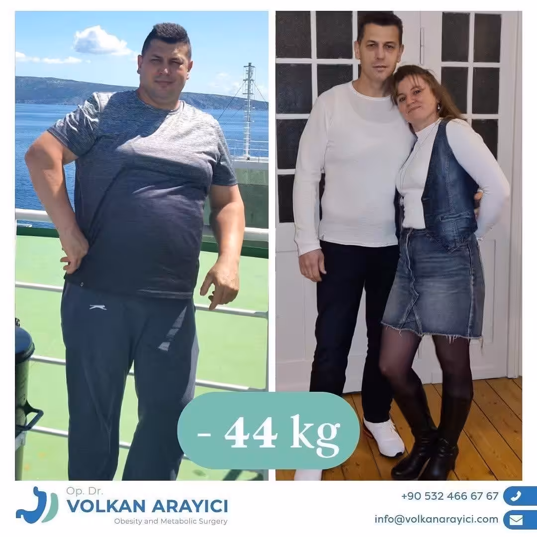 gewichtsreduktion türkei Vorher Nachher