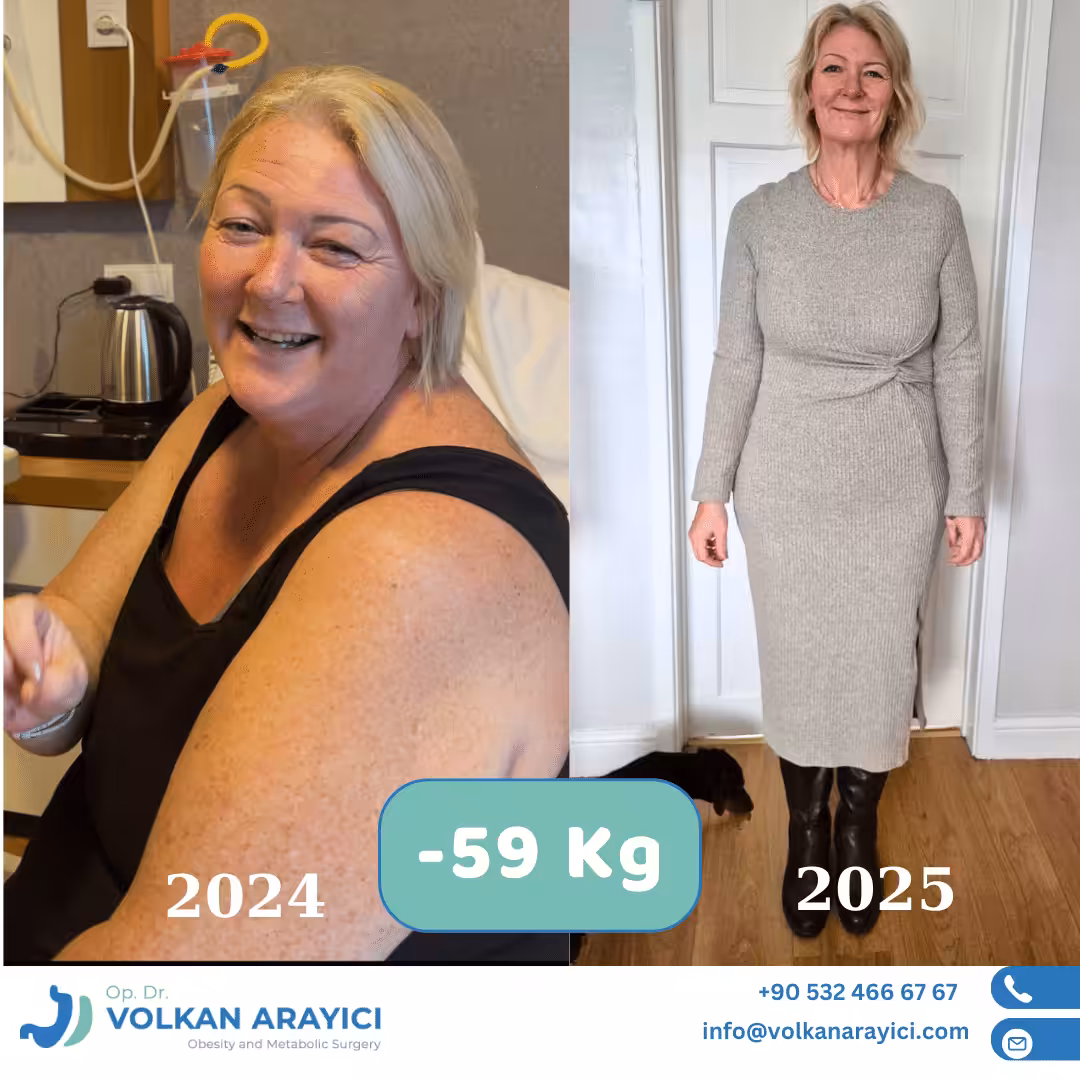 how much a gastric bypass cost