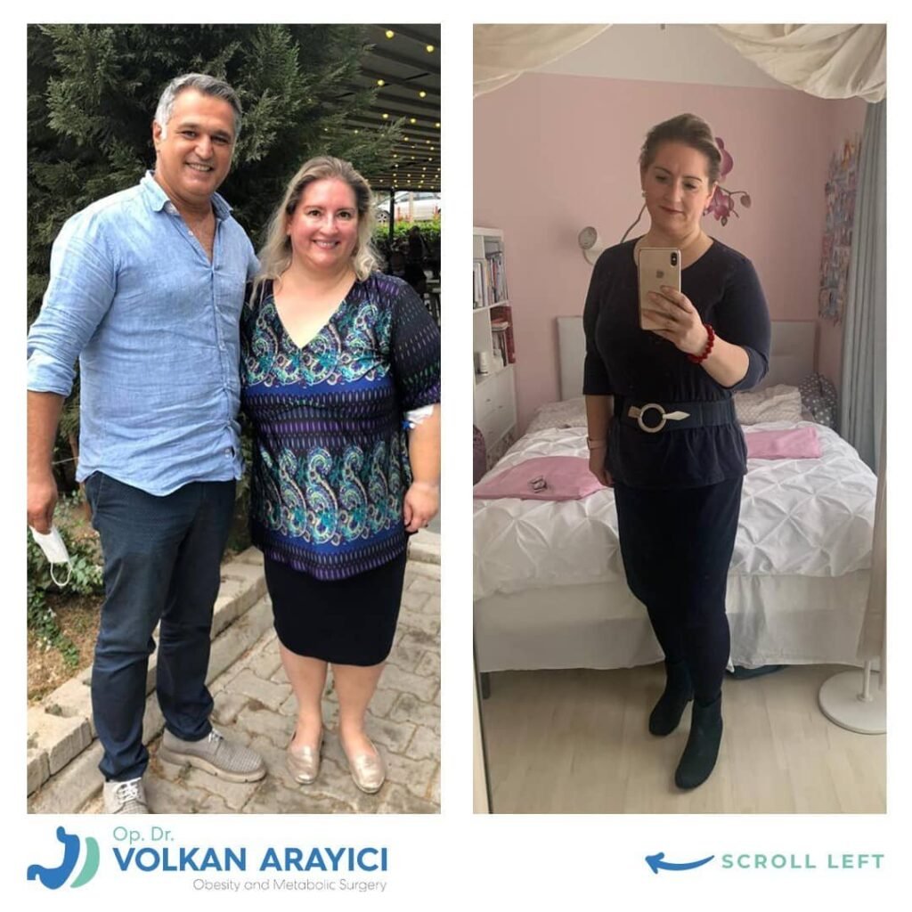 Adipositas Behandlung in der Türkei